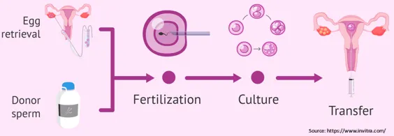 Sperm Donation in Mumbai - View Cost | Babies & Us