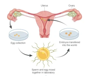 Embryo procedure