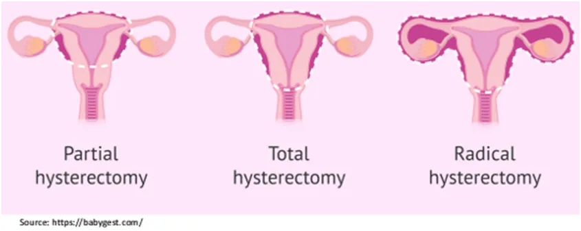 Gynecological Treatment in Mumbai