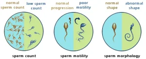 male Infertility Treatment in Mumbai