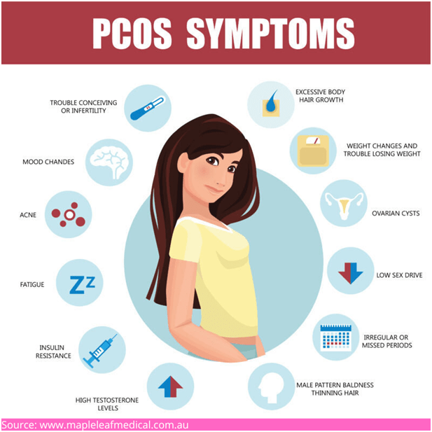 PCOS symptoms