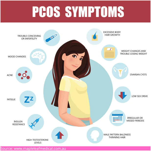 PCOS Symptoms | Babies & Us Fertility PCOS symptoms