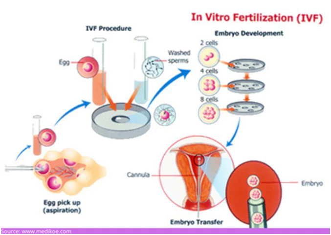 IVF Treatment in mumbai