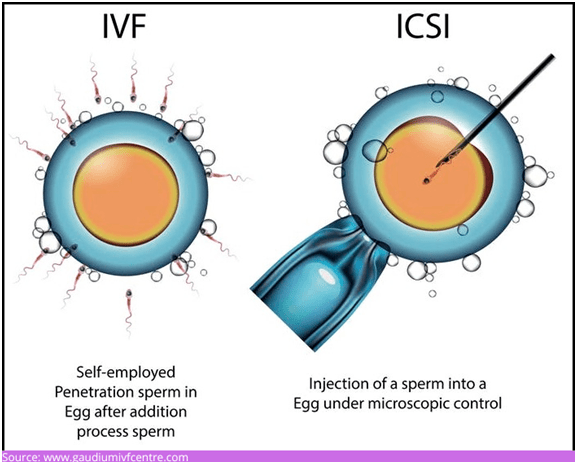 ICSI