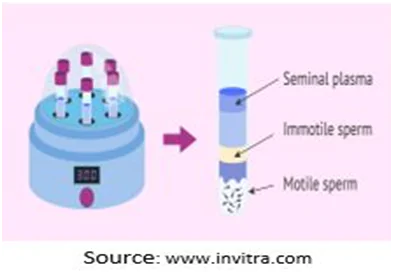 sperm procedure
