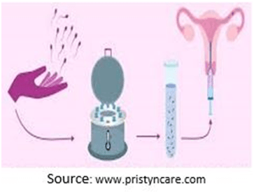 Sperm Insemination