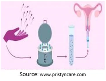 Sperm Insemination