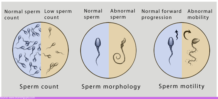 Sperm quantity