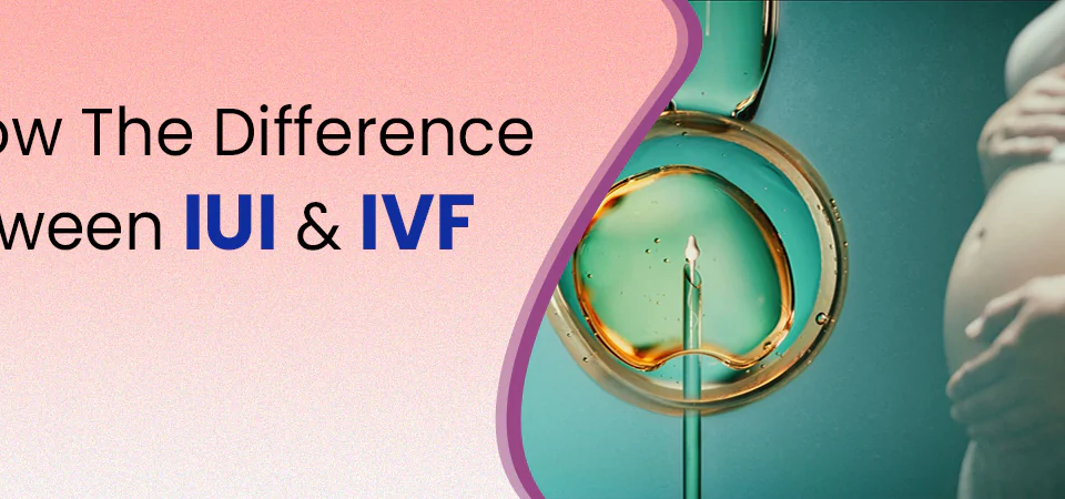 Know the Difference between IUI & IVF