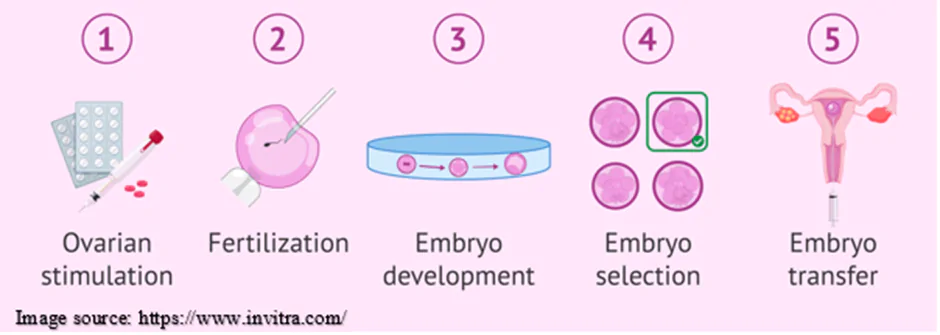ivf treatment