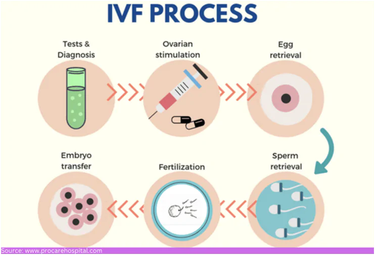 IVF process | Babies & Us Fertility ivf procedure in mumbai