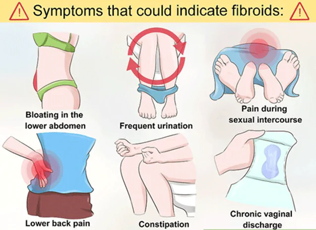 Symptoms indicating fibroids
