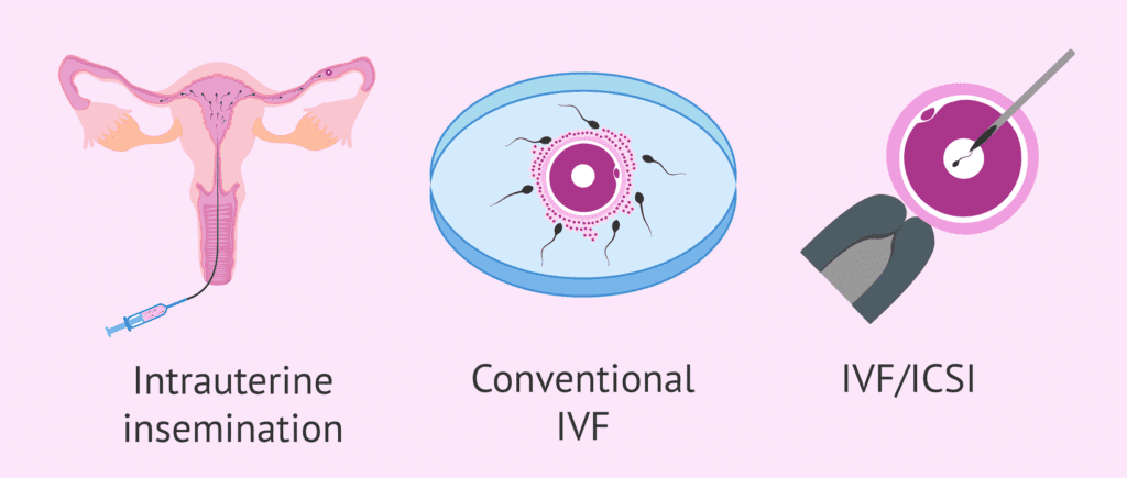 Assisted Reproductive Techniques (ART)