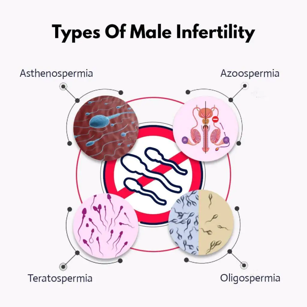 Types of Male Infertility