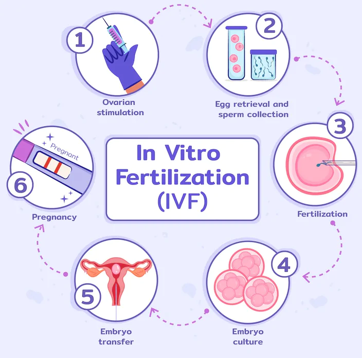 IVF (In Vitro Fertilization): 