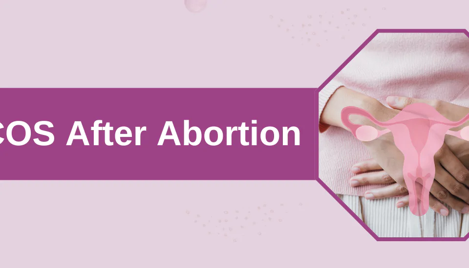 PCOS After Abortion