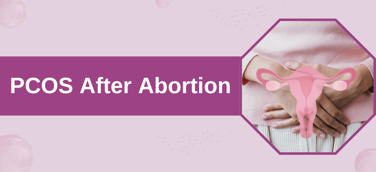 PCOS After Abortion