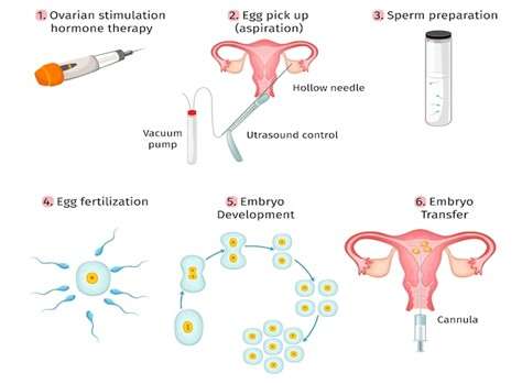 Frozen Embryo Transfer