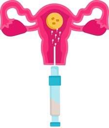 Success Rates of Frozen Embryo Transfer on Day 22 of Cycle