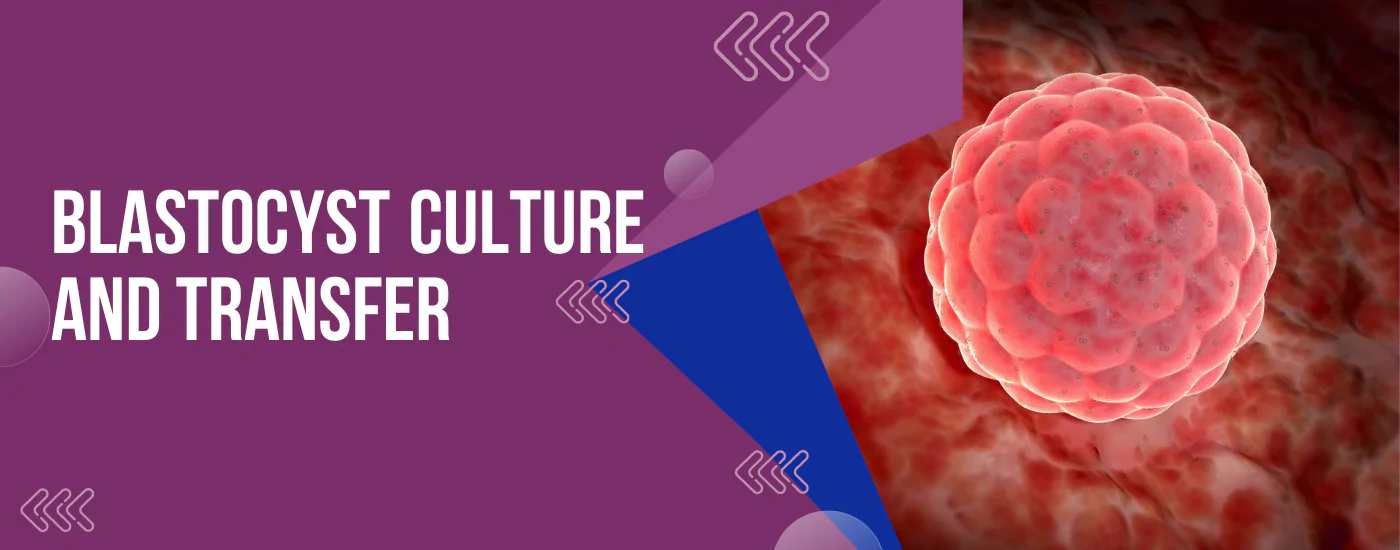 Blastocyst_Culture_and_Transfer | Babies & Us Fertility Blastocyst_Culture_and_Transfer