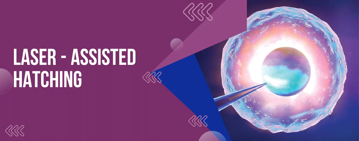 Laser_-_Assisted_Hatching | Babies & Us Fertility Laser_-_Assisted_Hatching