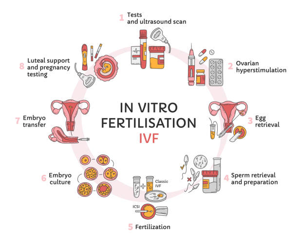 IVF Steps