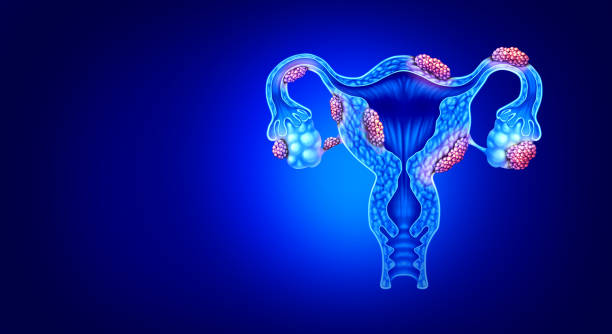 Uterine Fibroids Treatment in Mumbai