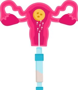 ICSI (Intracytoplasmic Sperm Injection)