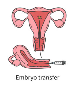 Embryo Transfer