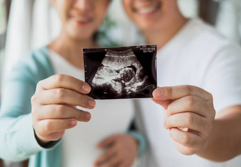 Picture1 | Babies & Us Fertility