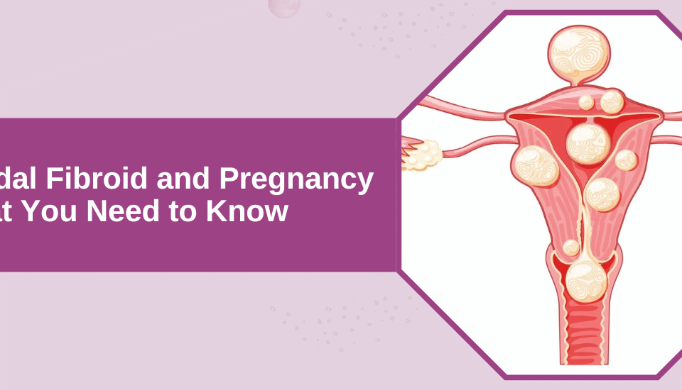 Fundal Fibroid and Pregnancy Banner